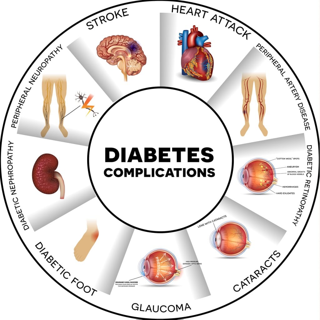 Waspada ! Inilah Ciri-ciri Diabetes yang Menyerang Anda !