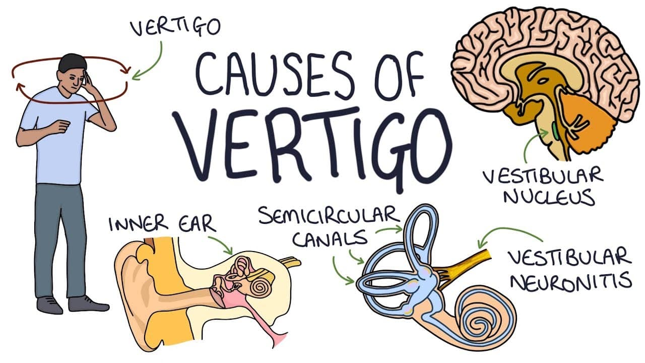 Ciri-ciri Vertigo, Penyebab & Pengobatannya